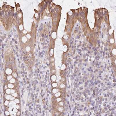 Immunohistochemistry-Paraffin: FAM208B Antibody [NBP1-90804]