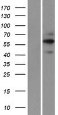 Western Blot: FAM20A Overexpression Lysate [NBP2-06963]