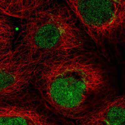 Immunocytochemistry/ Immunofluorescence: FAM210A Antibody [NBP2-13992]