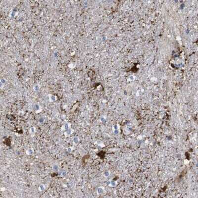 Immunohistochemistry-Paraffin: FAM210A Antibody [NBP2-13991]
