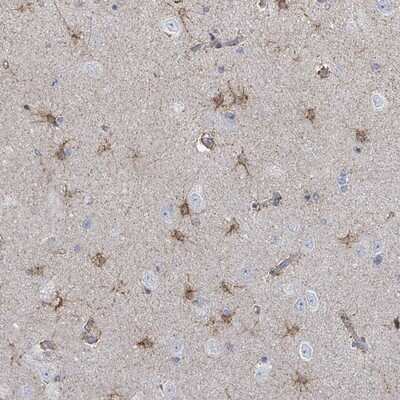 Immunohistochemistry-Paraffin: FAM210A Antibody [NBP2-13992]