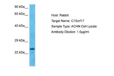Western Blot: FAM219B Antibody [NBP2-84911]