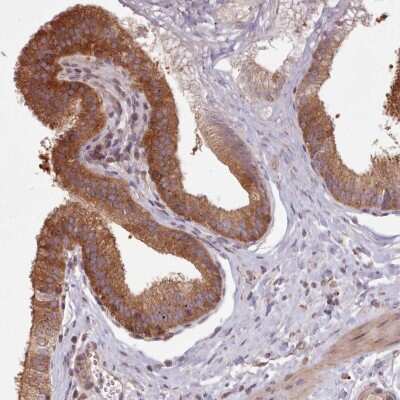 Immunohistochemistry-Paraffin: FAM21A Antibody [NBP2-59796]