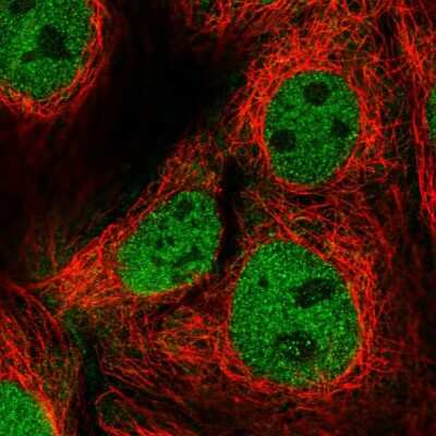 Immunocytochemistry/ Immunofluorescence: FAM222B Antibody [NBP2-14388]