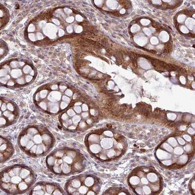Immunohistochemistry-Paraffin: FAM222B Antibody [NBP2-14388]