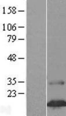 Western Blot: FAM24B Overexpression Lysate [NBL1-10515]