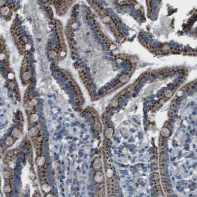 Immunohistochemistry-Paraffin: FAM3B Antibody [NBP1-89395]