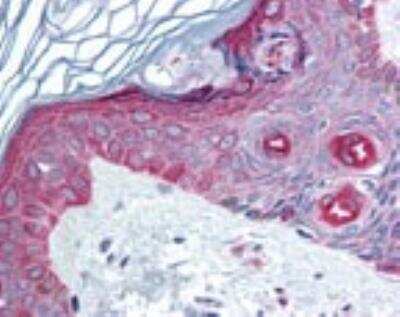 Immunohistochemistry-Paraffin: FAM3C Antibody [NBP2-24464]