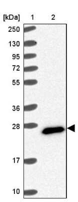 Western Blot: FAM3C Antibody [NBP2-13996]