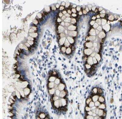 Immunohistochemistry-Paraffin: FAM3D Antibody [NBP2-30933]