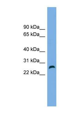 Western Blot: FAM3D Antibody [NBP1-57064]