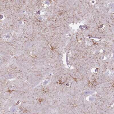 Immunohistochemistry-Paraffin: FAM43B Antibody [NBP2-14709]