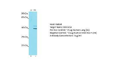 Western Blot: FAM45A Antibody [NBP2-82682]