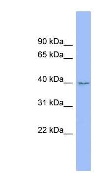 Western Blot: FAM45B Antibody [NBP1-79665]