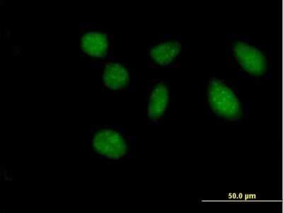 Immunocytochemistry/ Immunofluorescence: FAM47B Antibody [H00170062-B01P]