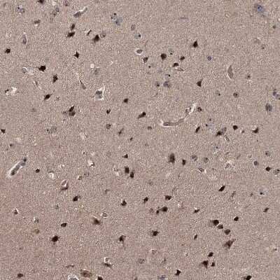 Immunohistochemistry-Paraffin: FAM48A Antibody [NBP1-90794]