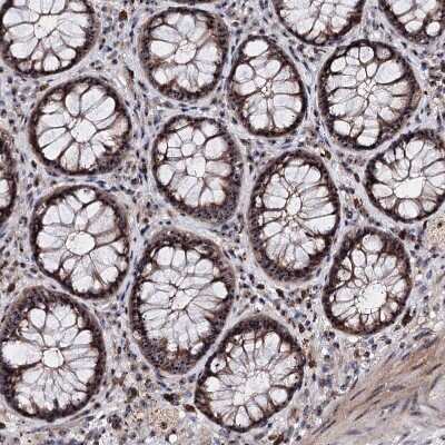Immunohistochemistry-Paraffin: FAM48A Antibody [NBP1-90794]