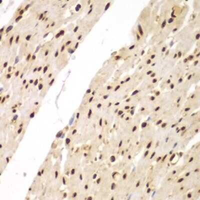 Immunohistochemistry-Paraffin: FAM48A Antibody - BSA Free [NBP3-03767]