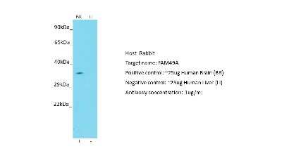 Western Blot: FAM49A Antibody [NBP2-82695]