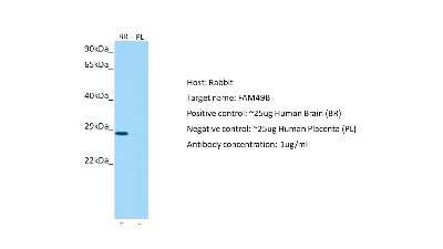 Western Blot: FAM49B Antibody [NBP2-82713]