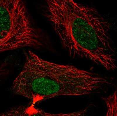 Immunocytochemistry/ Immunofluorescence: FAM50B Antibody [NBP2-49529]