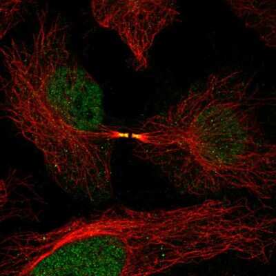 Immunocytochemistry/ Immunofluorescence: FAM50B Antibody [NBP2-56015]