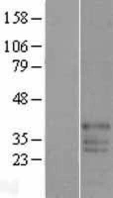 Western Blot: FAM50B Overexpression Lysate [NBL1-10538]