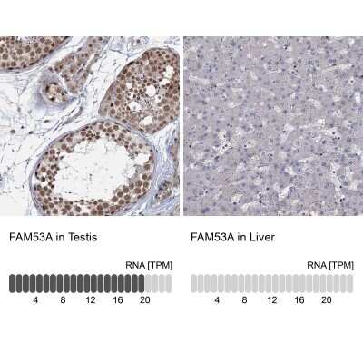 Immunohistochemistry-Paraffin: FAM53A Antibody [NBP1-84998]