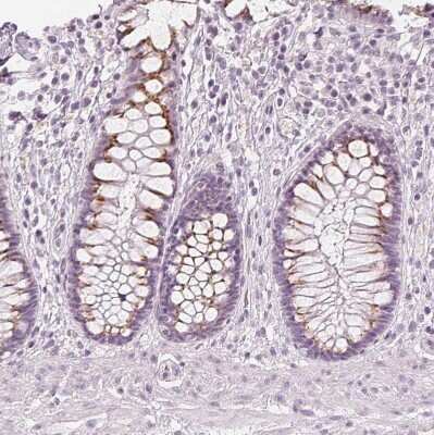 Immunohistochemistry-Paraffin: FAM55A Antibody [NBP2-14000]