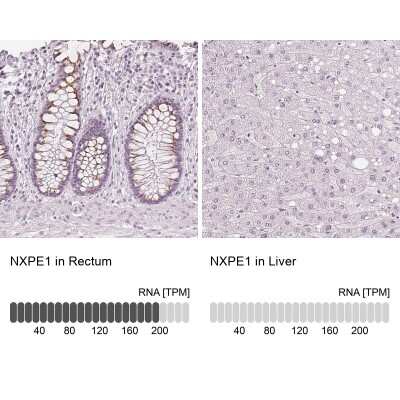 Immunohistochemistry-Paraffin: FAM55A Antibody [NBP2-14000]