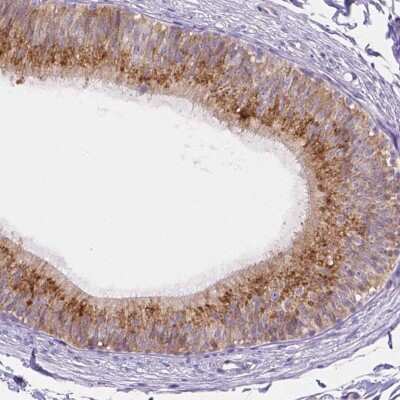 Immunohistochemistry-Paraffin: FAM55B Antibody [NBP2-30771]