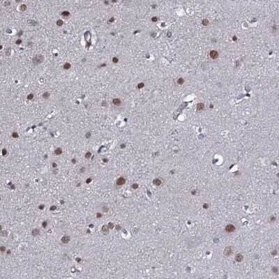 Immunohistochemistry: FAM59A Antibody [NBP2-47460]