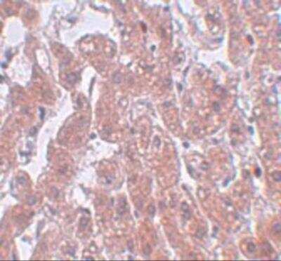 Immunohistochemistry: FAM59A Antibody - BSA Free [NBP2-81933]