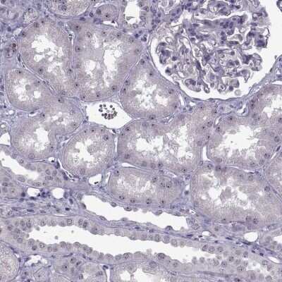 Immunohistochemistry-Paraffin: FAM60A Antibody [NBP2-68734]