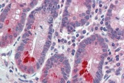 Immunohistochemistry-Paraffin: FAM62A Antibody [NBP3-14562]