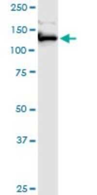Western Blot: FAM62A Antibody [H00023344-B01P]