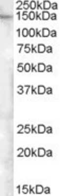 Western Blot: FAM62A Antibody [NBP1-00184]