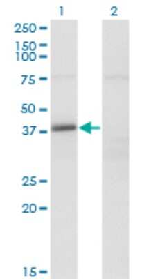 Western Blot: FAM62B Antibody (4C3) [H00057488-M02]