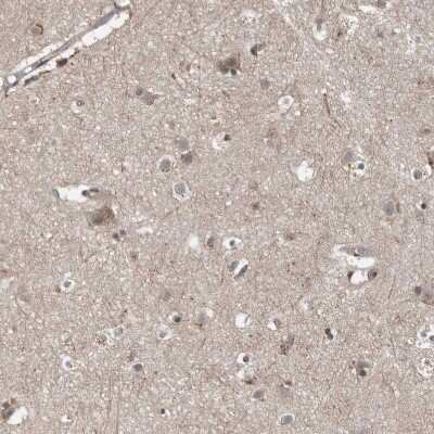 Immunohistochemistry-Paraffin: FAM63A Antibody [NBP1-83758]