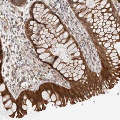 Immunohistochemistry-Paraffin: FAM63A Antibody [NBP1-83758]