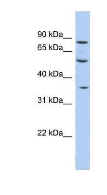Western Blot: FAM63A Antibody [NBP1-56831]