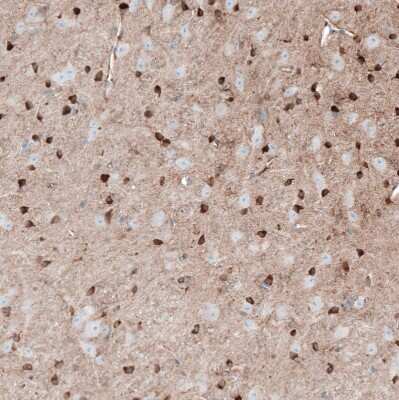 Immunohistochemistry-Paraffin: FAM70A Antibody [NBP2-30639]