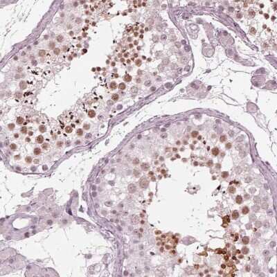 Immunohistochemistry-Paraffin: FAM71A Antibody [NBP1-83516]