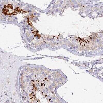 Immunohistochemistry-Paraffin: FAM71B Antibody [NBP1-82721]