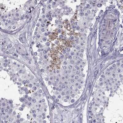 Immunohistochemistry-Paraffin: FAM71B Antibody [NBP1-82721]