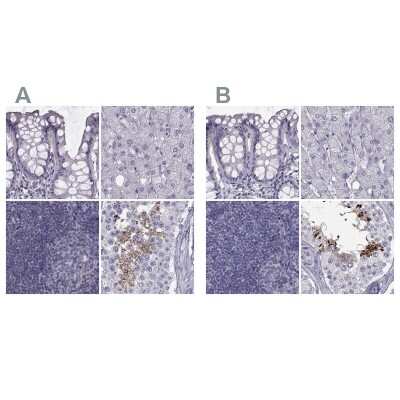 Immunohistochemistry-Paraffin: FAM71B Antibody [NBP1-82721]