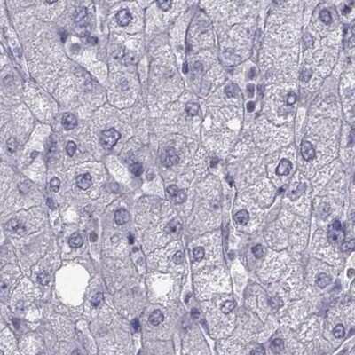 Immunohistochemistry-Paraffin: FAM71B Antibody [NBP1-82721]