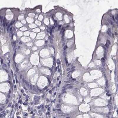 Immunohistochemistry-Paraffin: FAM71B Antibody [NBP1-82721]