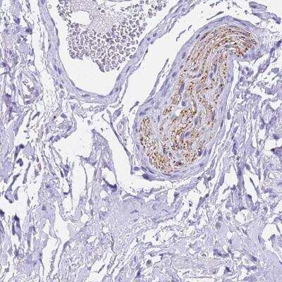 Immunohistochemistry-Paraffin: FAM72A Antibody [NBP2-59790]