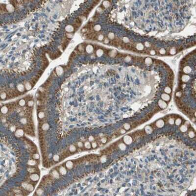 Immunohistochemistry-Paraffin: FAM73A Antibody [NBP1-93832]